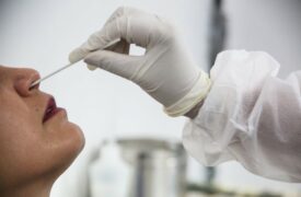 UEMA realizou testagem para COVID 19 nos profissionais do Campus Paulo VI